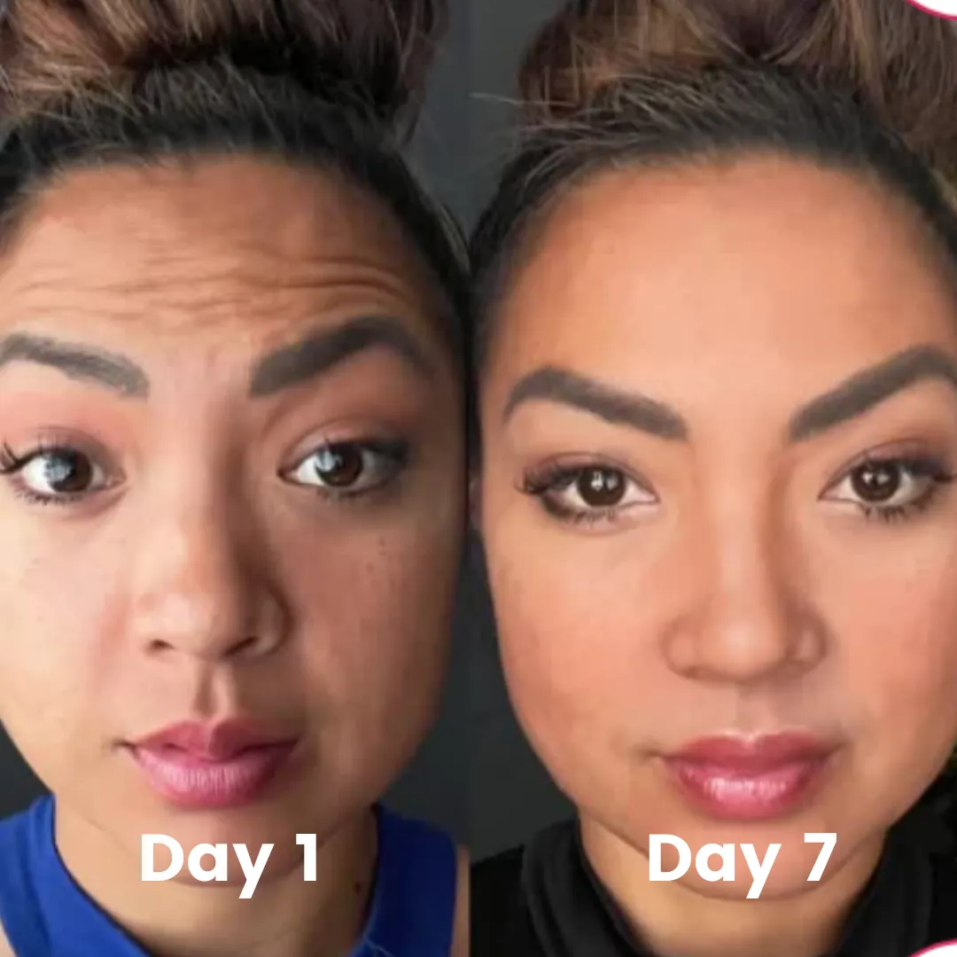 before-after-landing-page-1-img