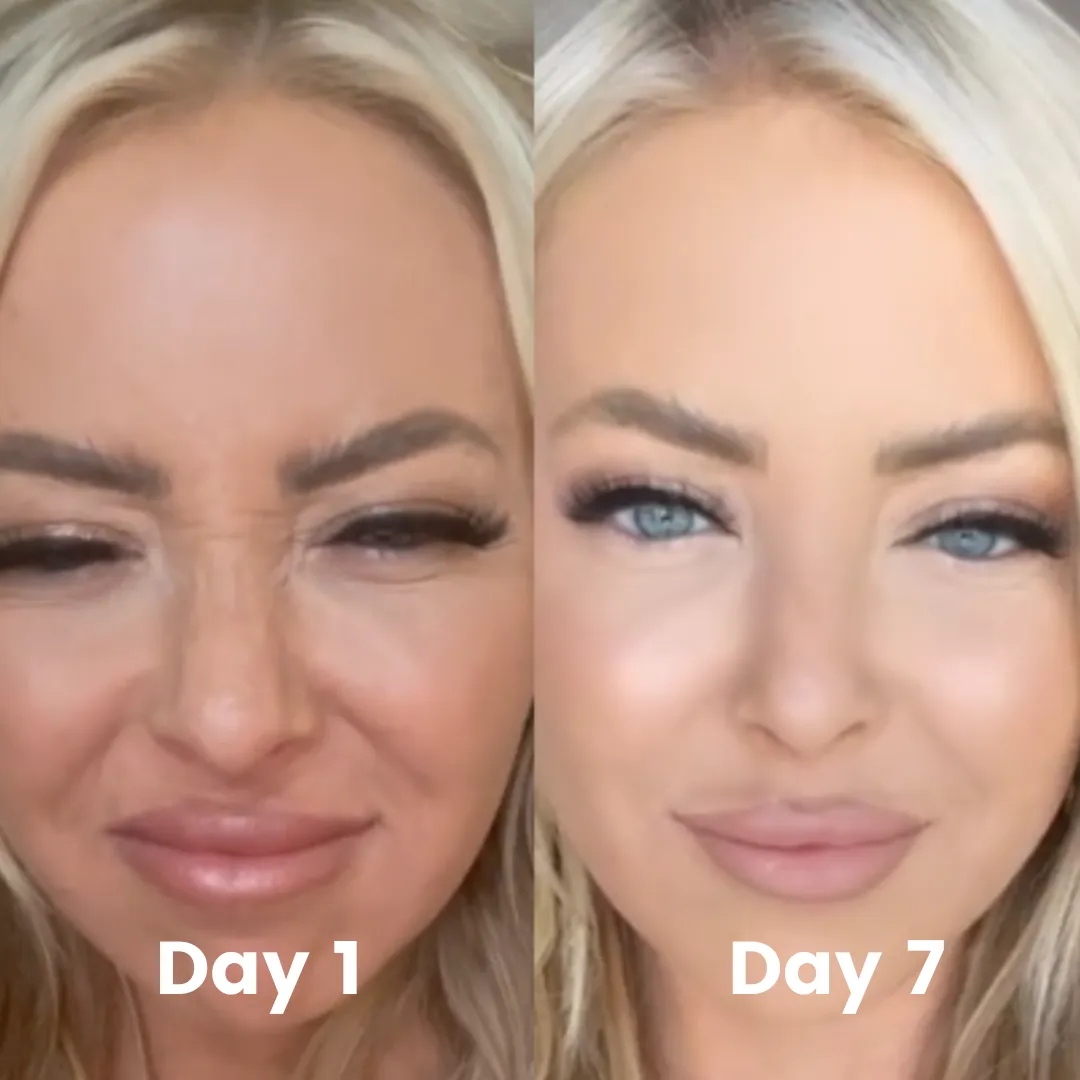 before-after-landing-page-2-img